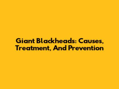 Giant Blackheads: Causes, Treatment, And Prevention