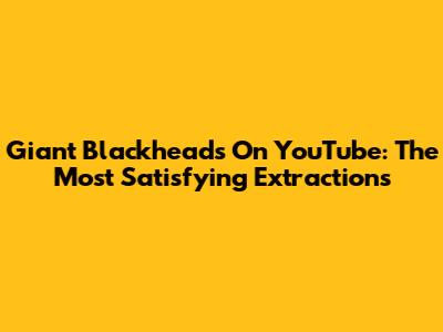 Giant Blackheads On YouTube: The Most Satisfying Extractions